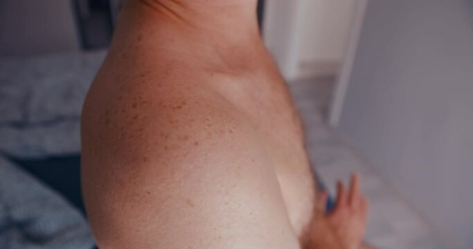 Close up of man skin with hyperpigmentation on shoulder