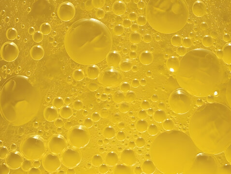 High color frothy urine with bubbles. Foamy excretion.