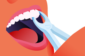 Cropped Beautiful Female Face White Teeth with Extracting Forceps Close Up. Modern Flat Vector Illustration.