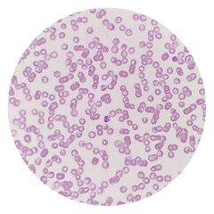 Babesia parasites inside red blood cell, the causative agent of babesiosis. Babesia canis is a parasite that infects red blood cells and can lead to anemia.