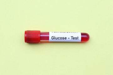 Glucose test to look for abnormalities from blood