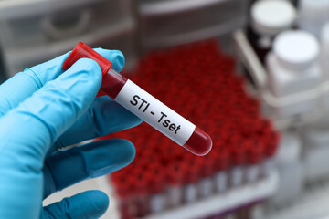 Obraz premium STI test to look for abnormalities from blood