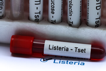 Listeria test to look for abnormalities from blood
