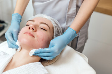 Beautician cleanse and moisturize the face of young female