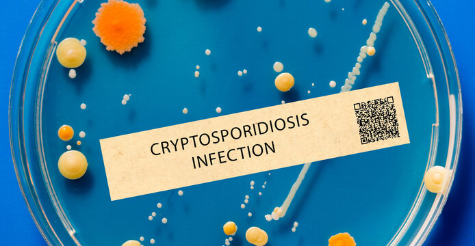 Cryptosporidiosis - Parasitic infection that can cause diarrhea and is transmitted through contaminated water.