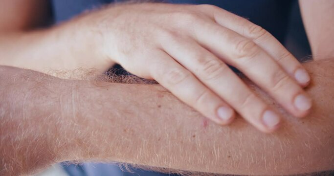 Hyperpigmentation on man hairy arm, dark spots on skin tone. close-up shot