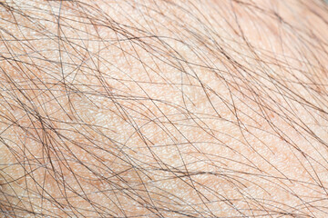 Macro human skin and hair,Hair on the body of the macro