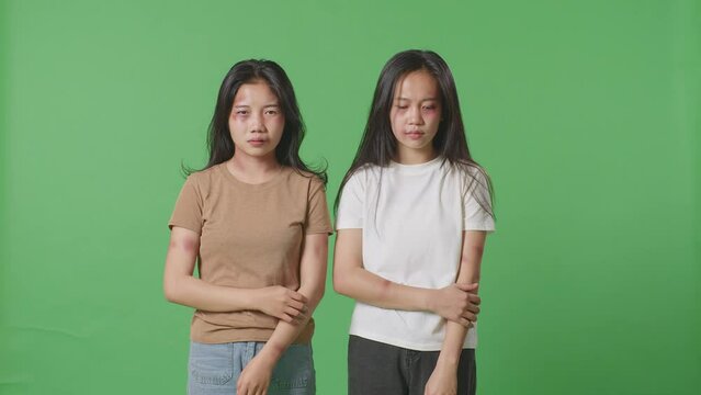 Young Asian Women Victims Of Violence Touching Bruises On Their Bodies That Caused From Physically Abused In The Green Screen Background Studio
