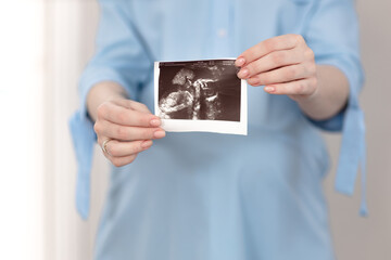 young pregnant woman holding ultrasound photo of her baby, pregnancy screening
