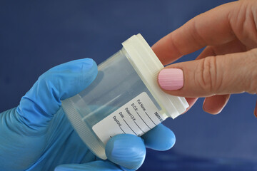 Medical personnel doctor nurse handing patient urine specimen cup for sample to be tested. 