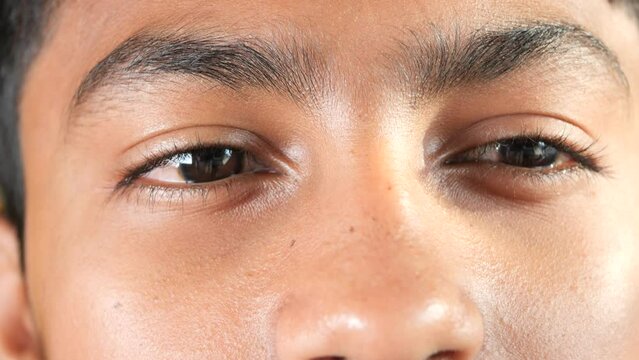 Closeup of bloodshot red eye