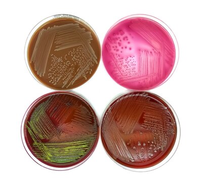 Escherichia coli colonies in MacConkey agar plate, Blood agar plate, Chocolate agar plate, and EMB agar plate 