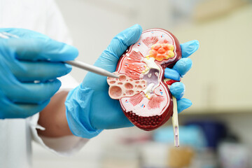 Chronic kidney disease, doctor holding model for treatment urinary system, urology, Estimated...