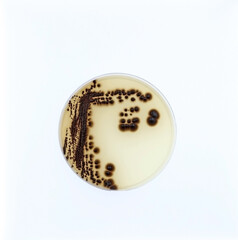 Black colonies of a species of bacteria that are growing on a Petri dish in the Microbiology laboratory.