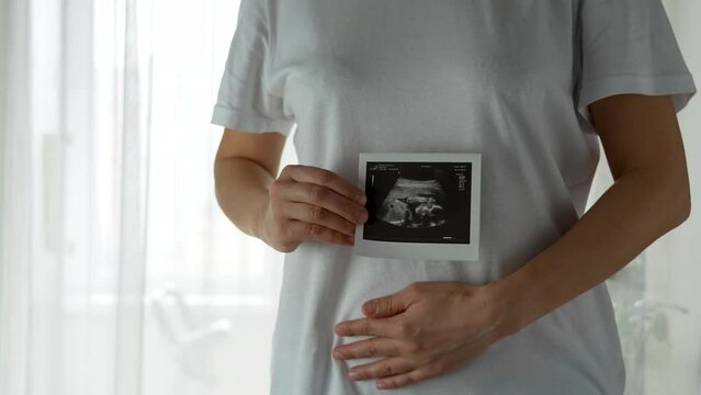 Pregnant woman holding ultrasound baby picture