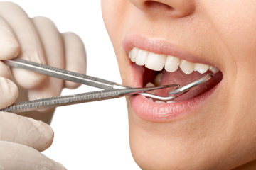 Woman teeth and a dentist mouth mirror on background