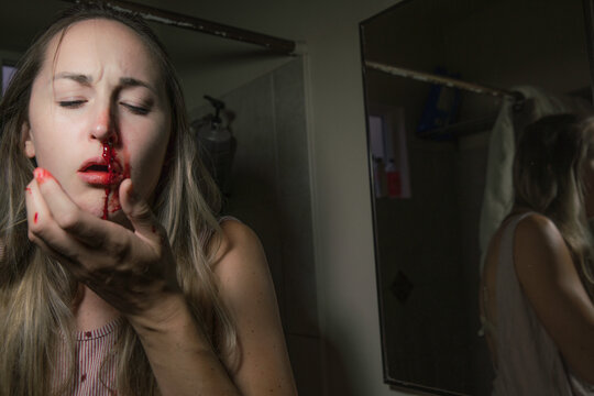 This image shows an injured young woman holding her face with a bloody nose. 