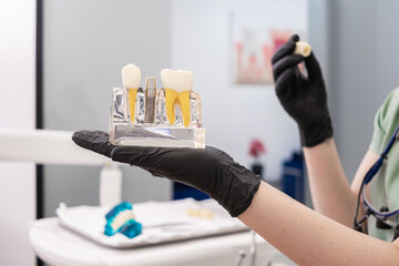Dentist hand with model of human teeth, highlighting the dental implant crown, and advising on...