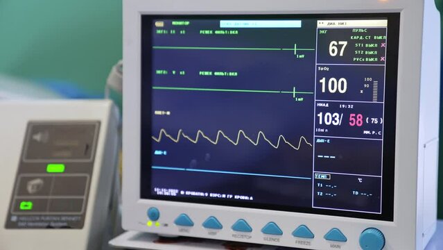 Screen with life signs of operated patient. Modern equipment working during surgery. Close up.