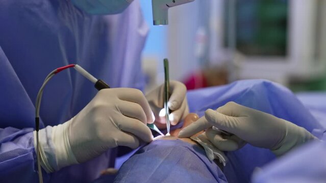 Gloved hands of surgeons carry out the blepharoplastic operation. Chief doctor uses modern device and assistant prepares tools. Close up.