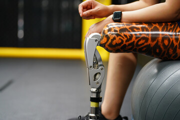 Young female with one prosthetic leg with the practice of using prosthetic legs to walk, exercise and and daily activities