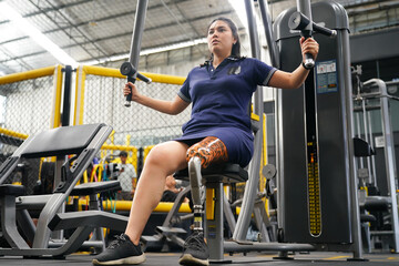 Fototapeta na wymiar Young female with one prosthetic leg with shoulder exercises with exercise machines to train the muscles in the torso and shoulders, the concept of living a woman's life with a prosthetic leg.