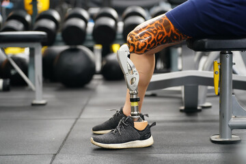 Young female with one prosthetic leg with the practice of using prosthetic legs to walk, exercise and and daily activities