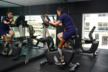 Young female with one prosthetic leg with exercising with a spinning bike in the gym to practice joint use with the other normal leg to be flexible, Concept of living a woman's life with a prosthetic