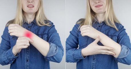 Before and after. In left woman is tormented by pain in her arm, hand, fingers, forearm....