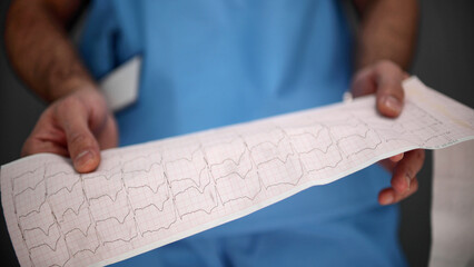 a doctor in a blue uniform looks at a cardiogram close-up