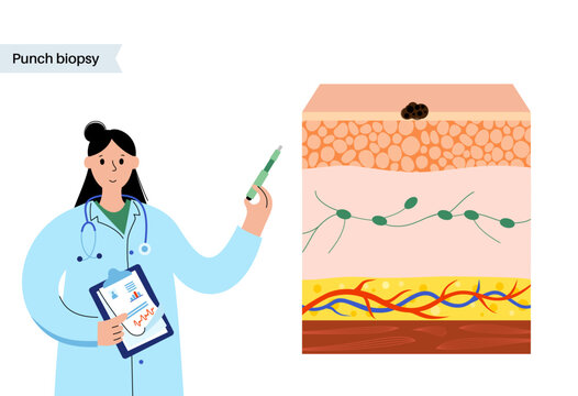 Punch biopsy procedure