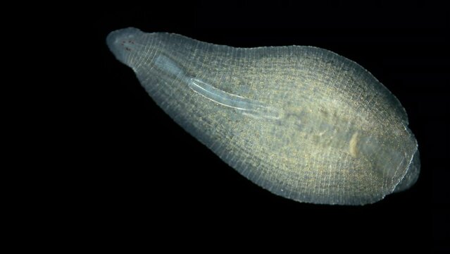 Leech family Glossiphoniidae under a microscope, order Rhynchobdellida. Possibly Alboglossiphonia sp. Sample size 5 mm, Lives in fresh water