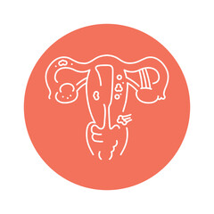 Endometriosis color line icon. Gynecology problem