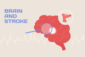 Brain and stroke concept illustration and poster in flat style