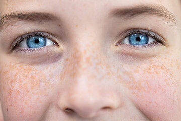 Close-up photo. Body part. Young happy and joyful face in freckles, blue eyes of a child, teenager,...