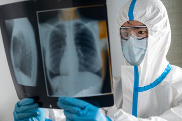 Doctor in a Covid ward of a hospital examining x-rays of the lungs.