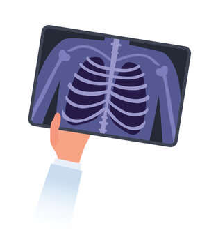 Hand holds x-ray image of humans ribs and lungs. Fluorography and radiography concept. Medical examination and diagnosis flat illustration. Vector design isolated on white background
