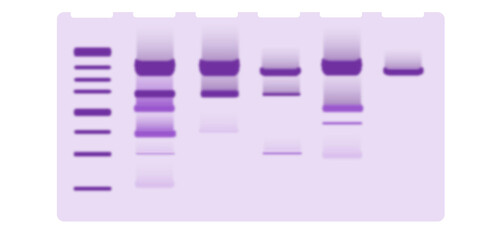  Illustration of protein gel electrophoresis. SDS page illustration