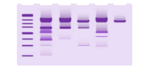 Illustration of protein gel electrophoresis. SDS page illustration