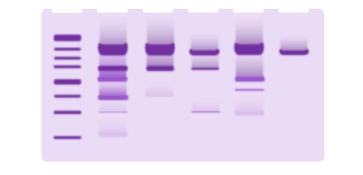  Illustration of protein gel electrophoresis. SDS page illustration