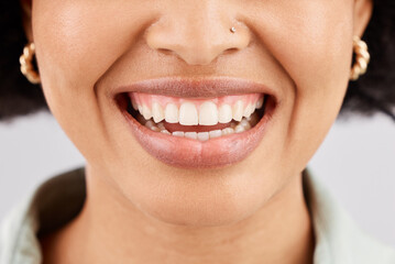 Smile, dental teeth and face of black woman in studio isolated on a white background. Tooth care,...