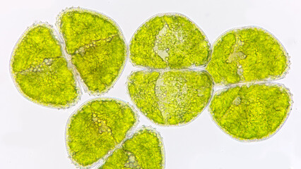A green algae called Cosmarium. The species probably Cosmarium decoratum. live specimen. 400x...