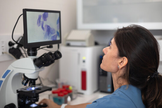 veterinarian viewing image on the digital display of the microscope.