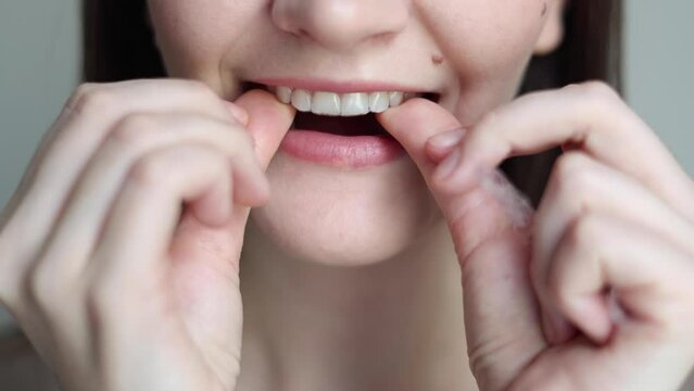A young girl uses aligners to straighten her teeth