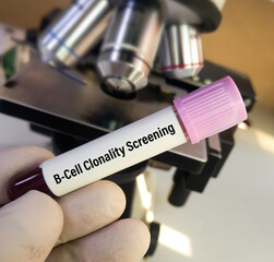 Scientist hold blood sample for B-Cell Clonality Screening (IgH and IgK) by PCR test to diagnosis of B-cell lymphoproliferative disorders, B-cell lymphomas or leukemias.