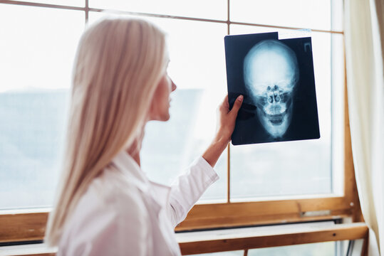 Woman Doctor Looking at X-Ray Radiography in hospital.
