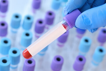 Hand with medical glove of doctor holds test tube with blood sample and blank label for own text on the background of medical test tubes.