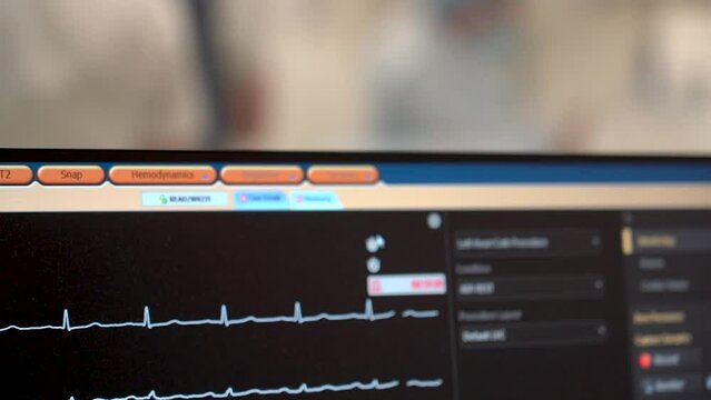 Kyiv, Ukraine - April 2023: Heart Institute. The patient monitor shows heart data. Lines on the monitor of the patient, a graph of the vital activity of the organism. On the wall is a working patient 