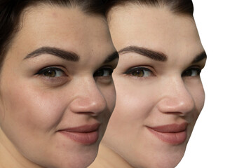 Woman face wrinkles before and after treatment