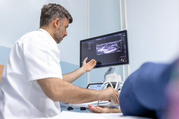 At the medical clinic, Caucasian male doctor doing the doppler ultrasound test evaluation of arteries and veins on a female patient - obrazy, fototapety, plakaty